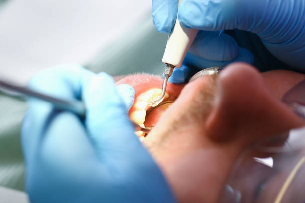 Best Emergency Treatment for Toothache in Arlington, WA